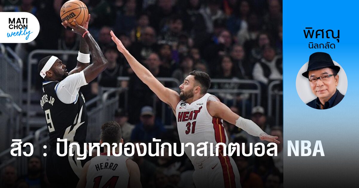 สิว : ปัญหาของนักบาสเกตบอล NBA