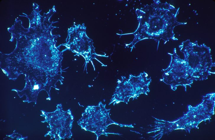 cancer-cells-541954