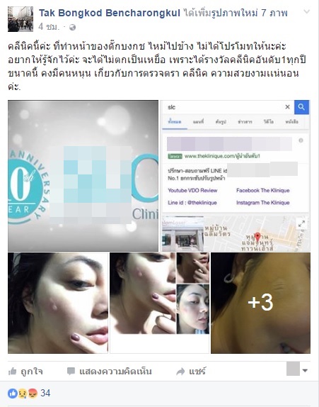 ตั๊ก บงกช หน้าไหม้ (2)