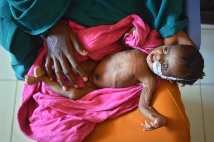 SOMALIA-CONFLICT-DROUGHT-FAMINE