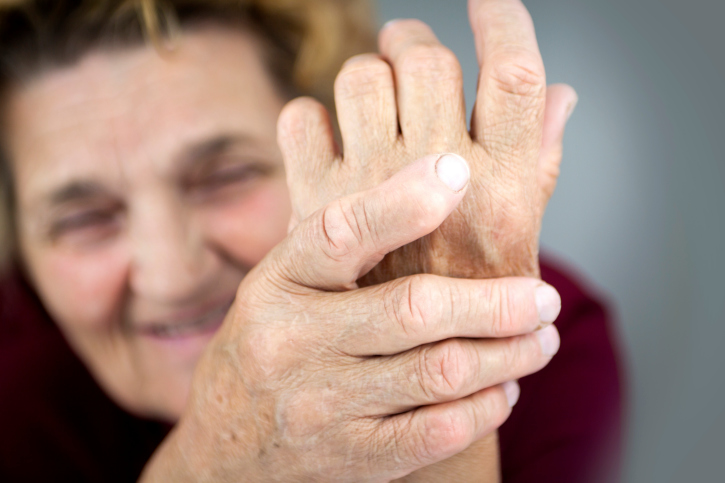 Hands Of Woman Deformed From Rheumatoid Arthritis