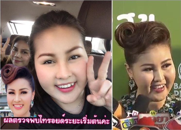หญิงลี หาหมอ 1