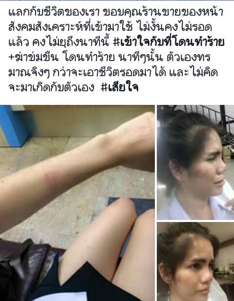 โพสต์1