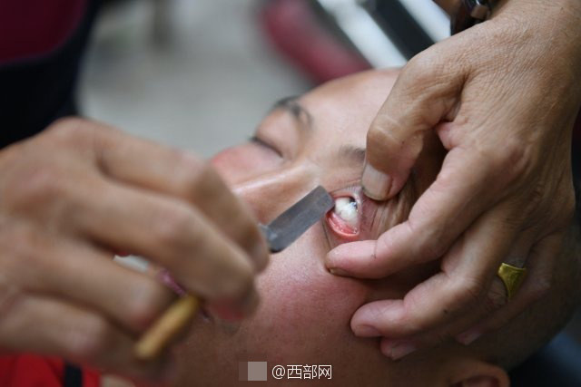 eye_cleaning5