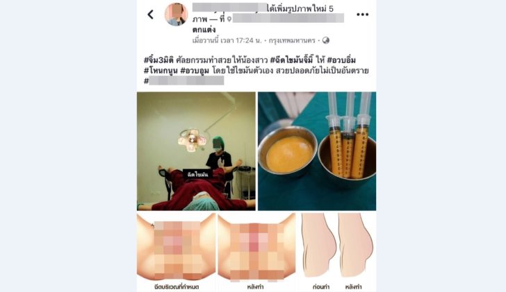 จิมิ