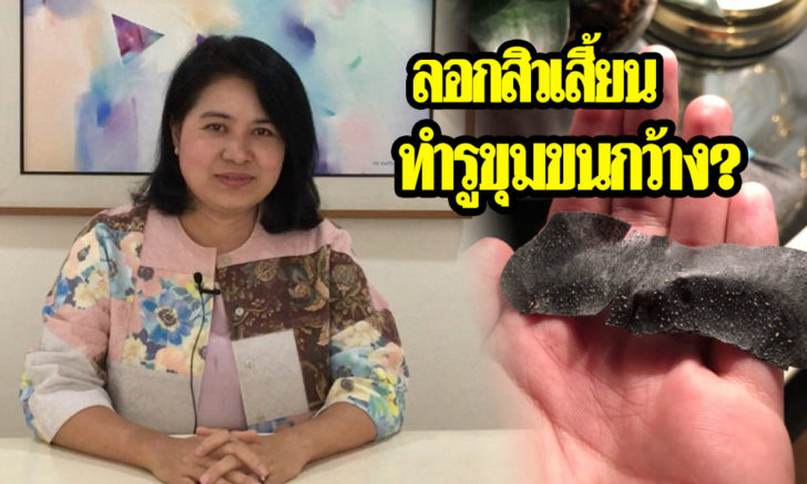สิว