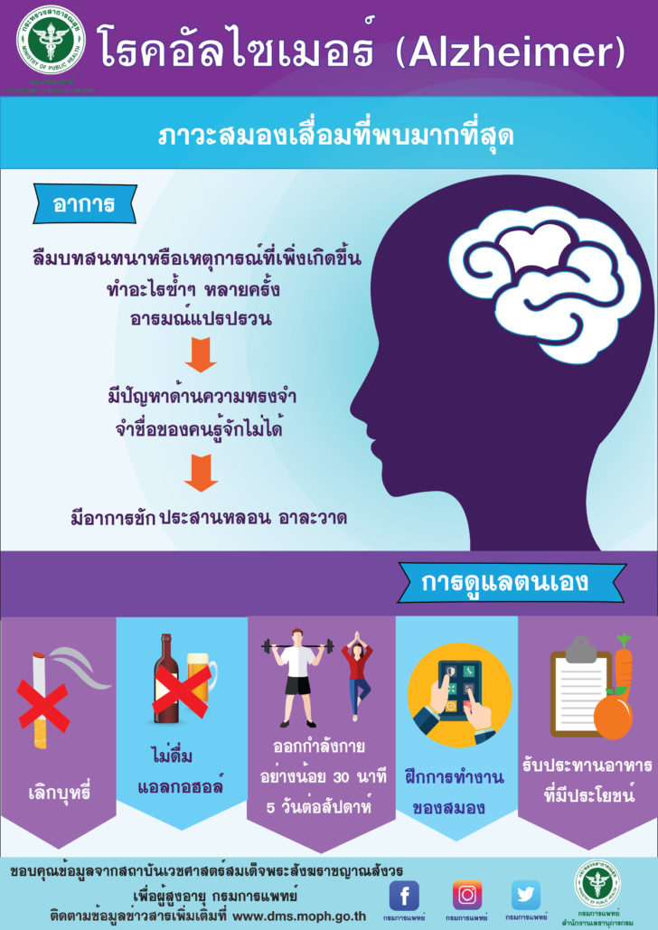 Alzheimer