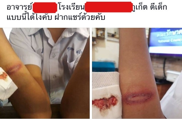 ตี