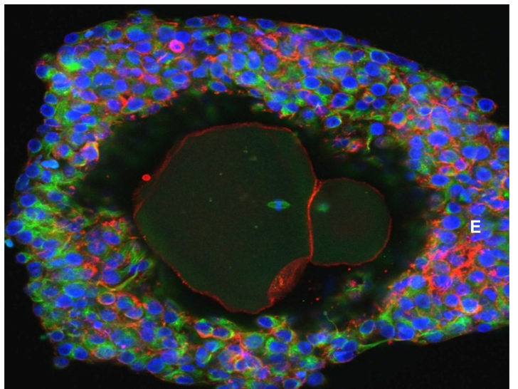 An undated picture shows a magnification of a lab-grown fully matured human egg ready for fertilization