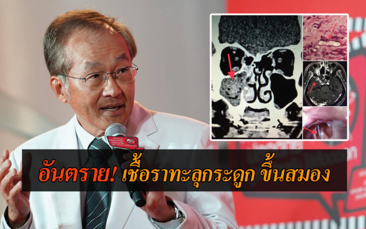 เชื้อรา
