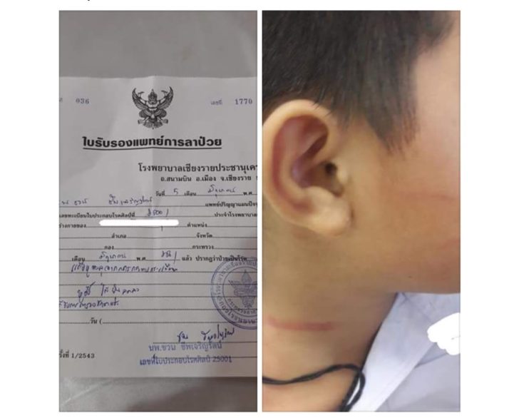เด็กพิเศษ01