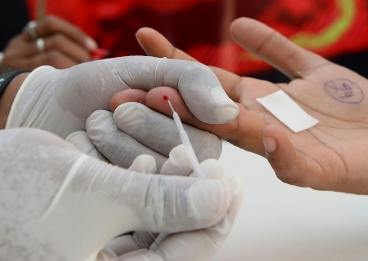 antibody HIV