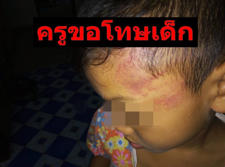 เด็กโดนครูตี