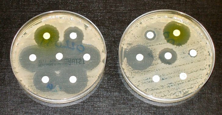 superbugs
