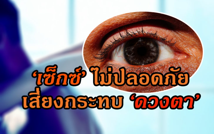 เซ็กซ์