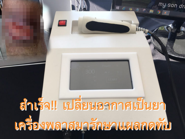 แผลกดทับ