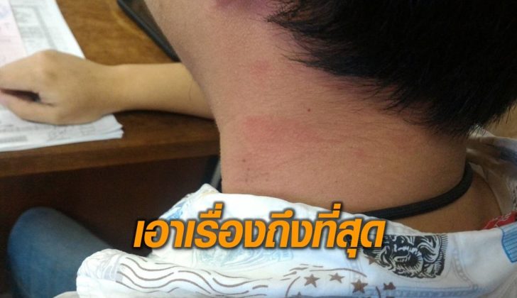 บีบคอ
