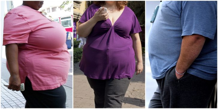 HEALTH-OBESITY