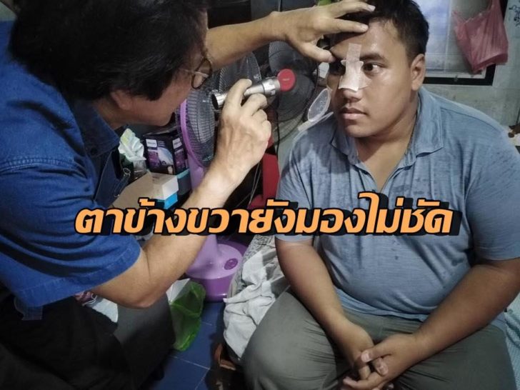 จ่านิว2-