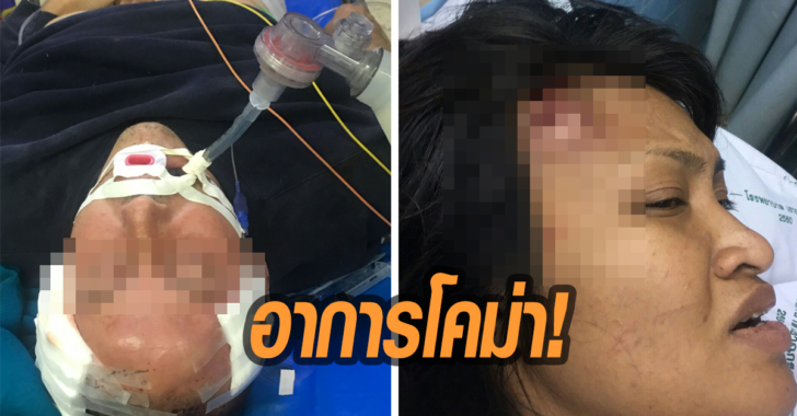 อาการโคม่า