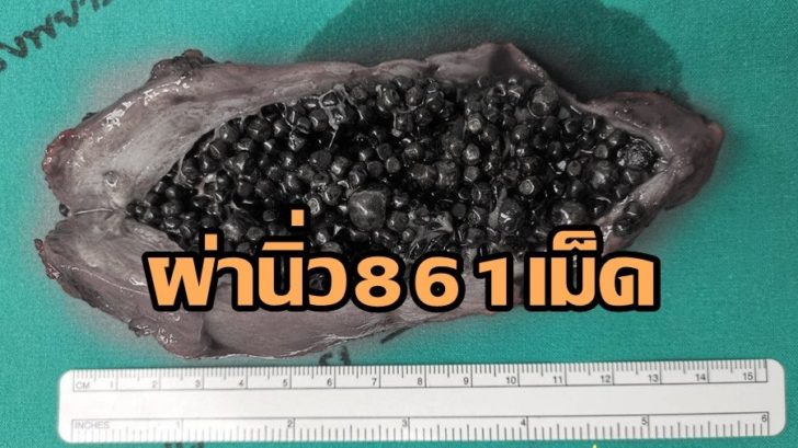 นิ้ว