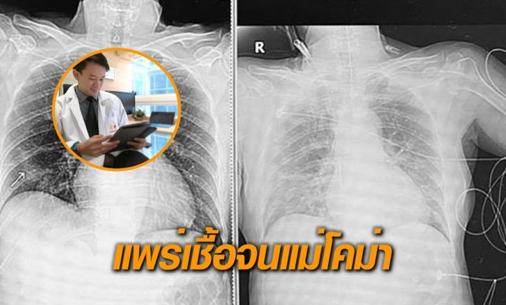 ลูกแพร่เชื้อแม่