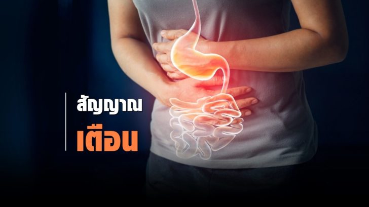 Stomach Cancer_1