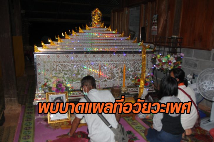 ผลชันสูตรรอบ 2 ศพ 'น้องชมพู่' พบบาดแผลที่อวัยวะเพศ มีร่องรอยการทำร้ายร่างกาย