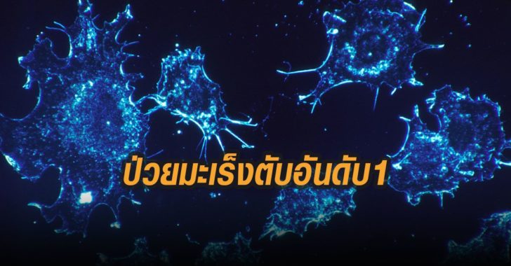 ป่วยมะเร็งตับอันดับ1