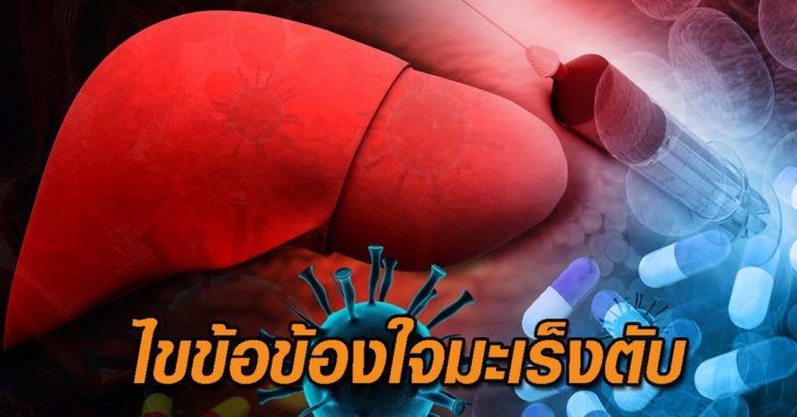 มะเร็งตับ