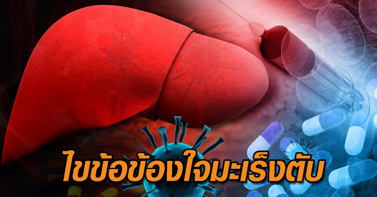 มะเร็งตับ