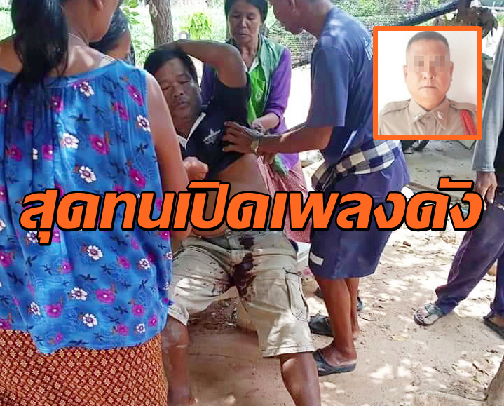 ด.ต.หัวร้อน5
