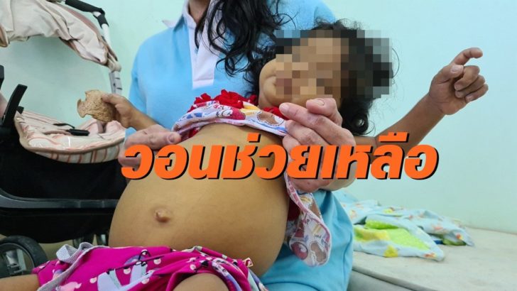 ท้องโต