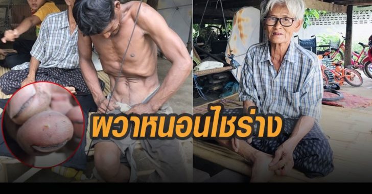 ผวา-ยายหลานหนอนไชร่างกาย