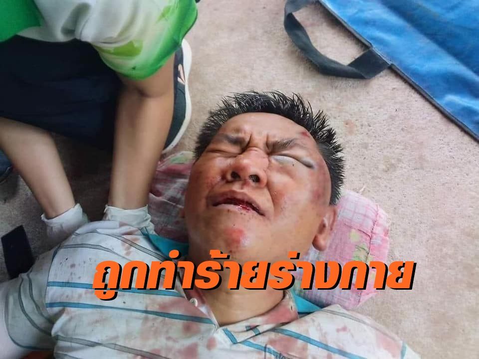 ผู้กองปูเค็ม ถูกทำร้ายที่ฉะเชิงเทรา หลังนำจับตู้สล็อตกลางตลาดโต้รุ่ง