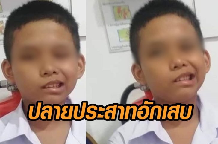พักผ่อนน้อย-ปลายประสาทอักเสบ