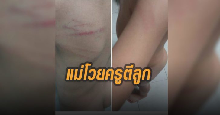 แม่โวยครูตีลูก-สงขลา