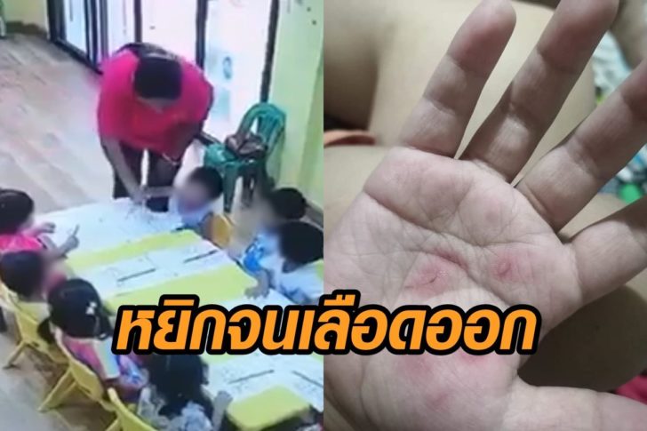 ครูหยิกมือ