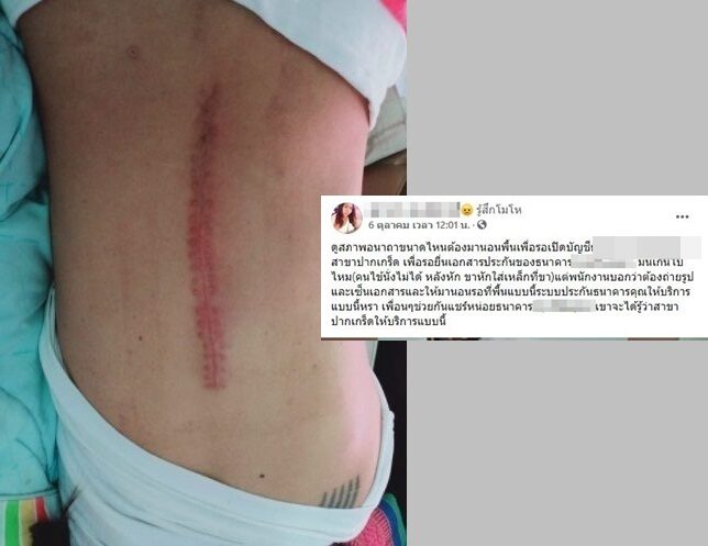 หลังหัก3-