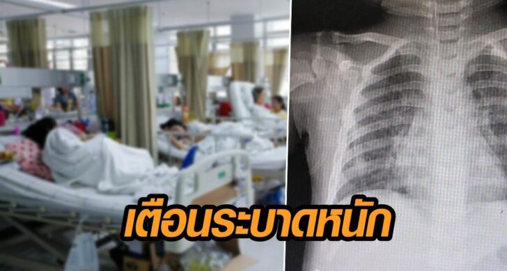อาร์เอสวี