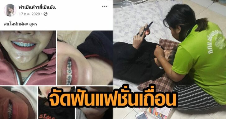 จัดฟันเถื่อน