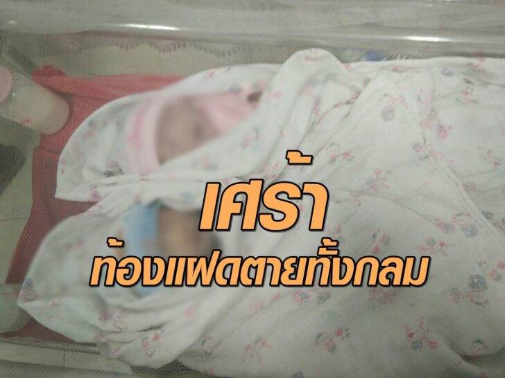 ท้องแฝดตายทั้งกลม