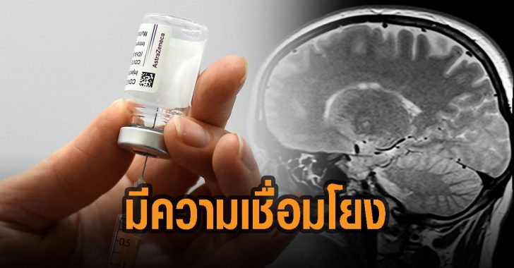 มีความเชื่อมโยง-วัคซีน-กับ-ลิ่มเลือดอุดตัน