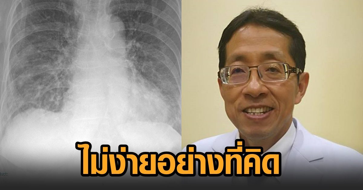 ‘หมอนิธิพัฒน์’ เผย ปอดอักเสบโควิดไม่ง่ายอย่างที่คิด ติงแผนกระจายวัคซีนบิดเบี้ยว เกิด ‘เข็มสองนัดแล้วไม่มา’