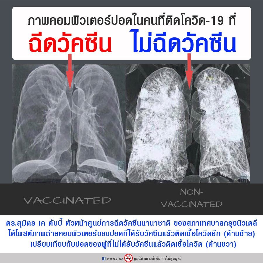 à¹€à¸— à¸¢à¸šà¸Š à¸