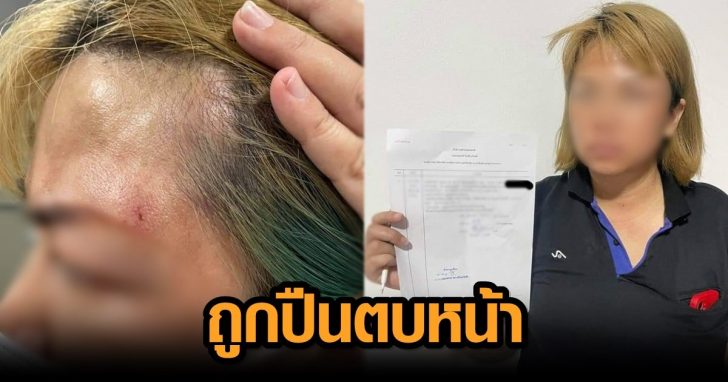 ถูกปืนตบหน้า