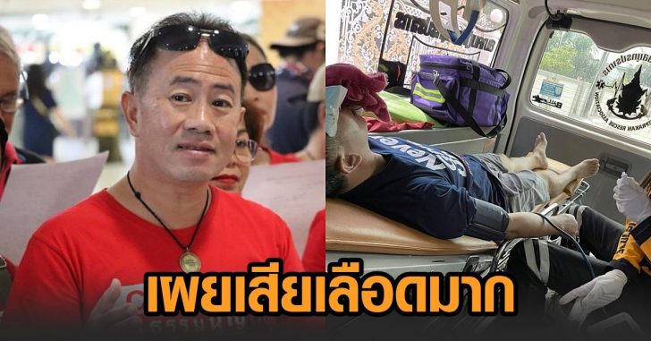 ฟอร์ด-เสียเลือดมาก