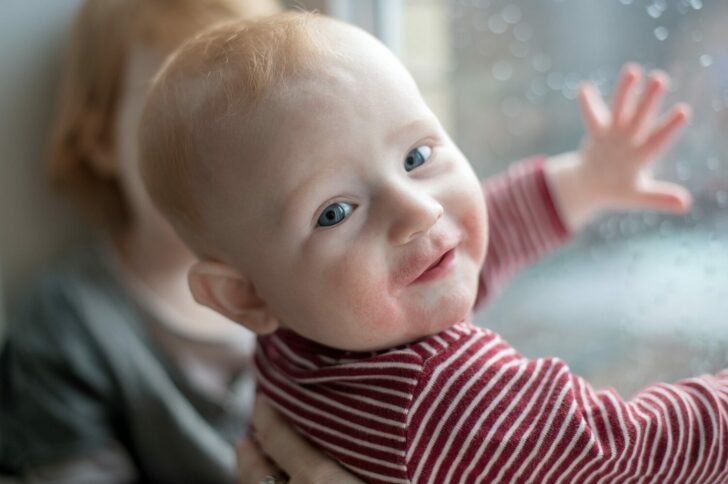 Baby,With,Manifestations,Of,Food,Allergy,On,The,Face