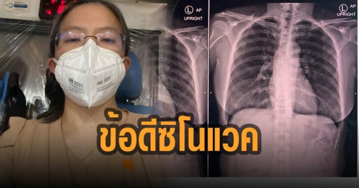 หมอภูมิคุ้มกัน-เผยข้อดีซิโนแวค