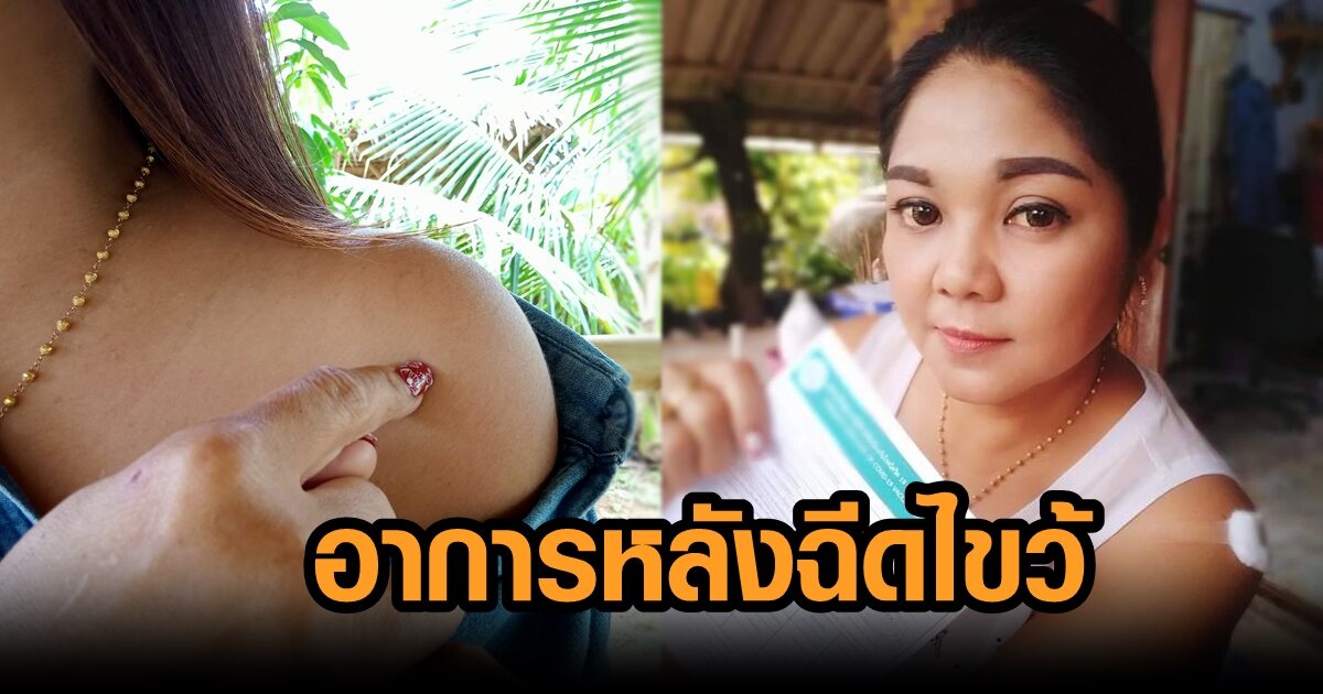 ข้าราชการอบต. แขนยกไม่ขึ้น ต้องทำกายภาพ หลังฉีดวัคซีนไขว้ แพทย์ระบุ ถุงน้ำที่ข้อต่อไหล่อักเสบ